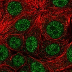 NBEAL1 Antibody, Novus Biologicals 25 &mu;L, Unlabeled:Antibodies, Polyclonal